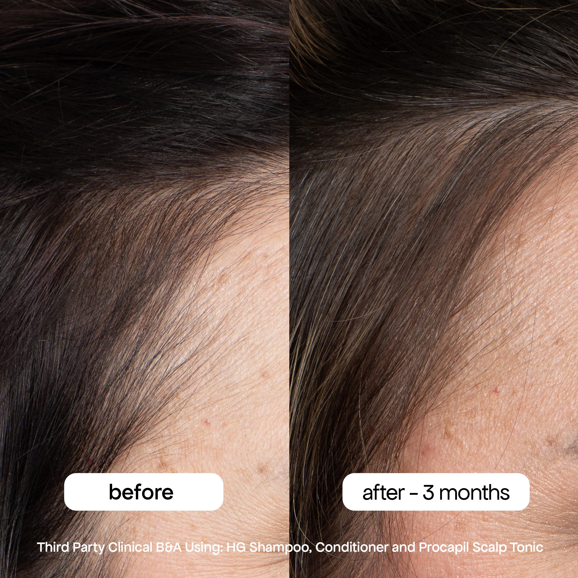 ANTI-THINNING PROCAPIL® SCALP TONIC - Image 6