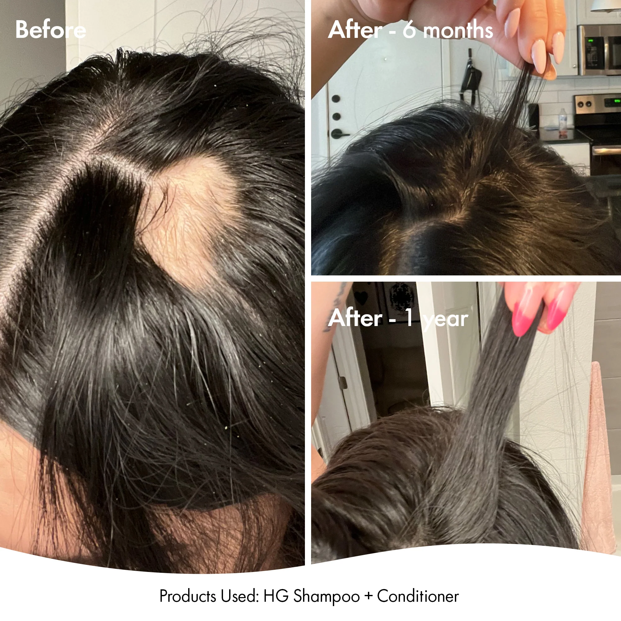 ANTI-THINNING SUPER SYSTEM - Image 5