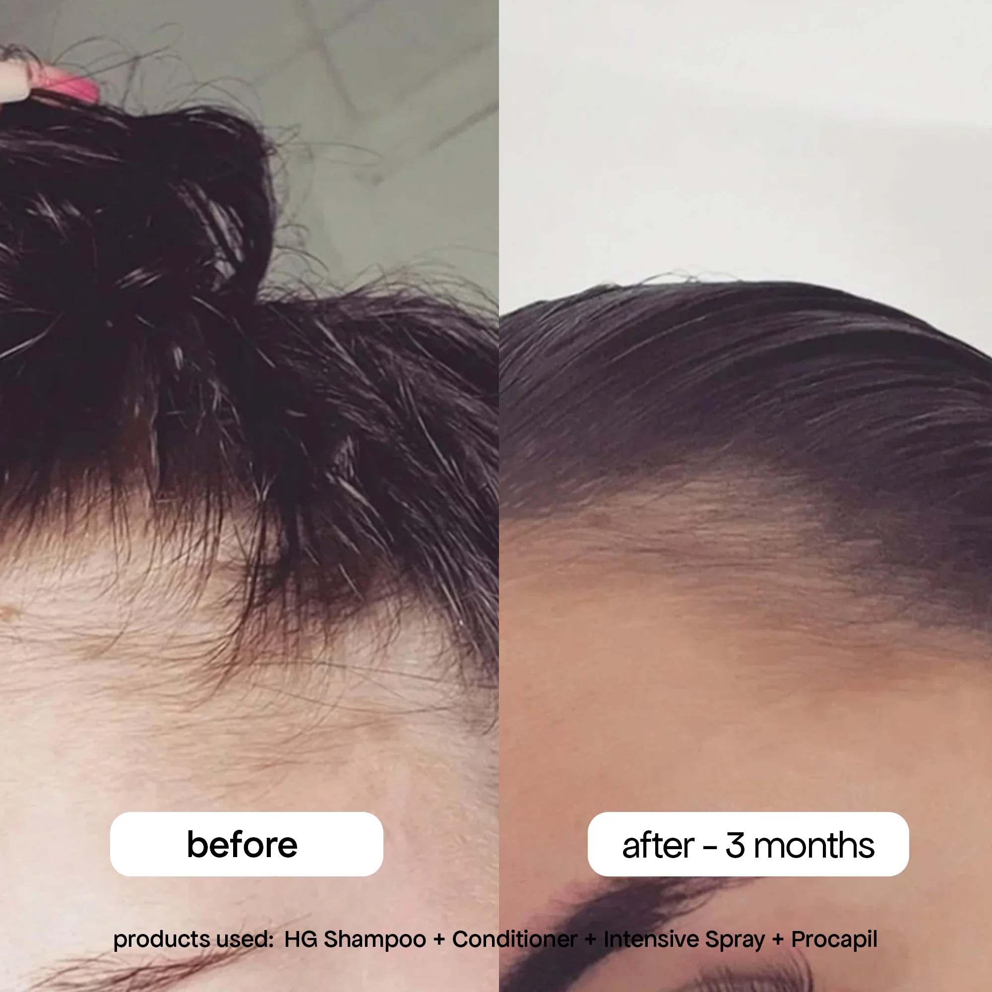ANTI-THINNING INTENSIVE SCALP SPRAY - Image 3
